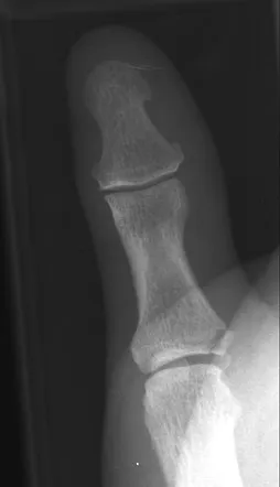 https://radiopaedia.org/images/293