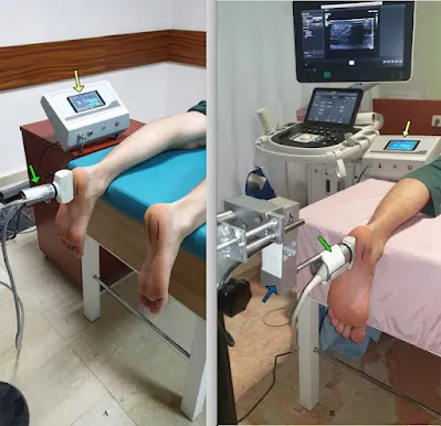 臨床治療照片,分 A、B 兩格:足踝接受儀器治療與超音波檢查的設置